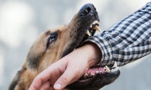 South Carolina Dog Bite Injury Lawyer