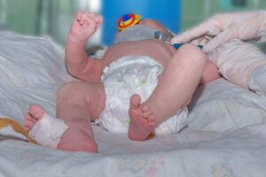 Experienced Lawyer for Birth Injury Lawyer ​South Carolina.