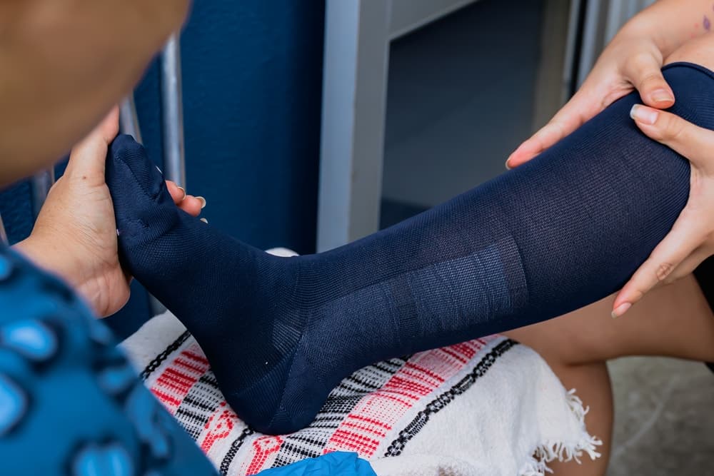 Domestic nurse putting compression stocking on woman with broken foot